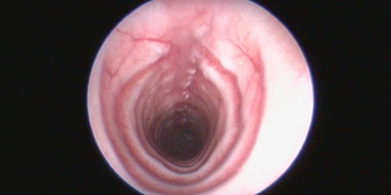 Trachea